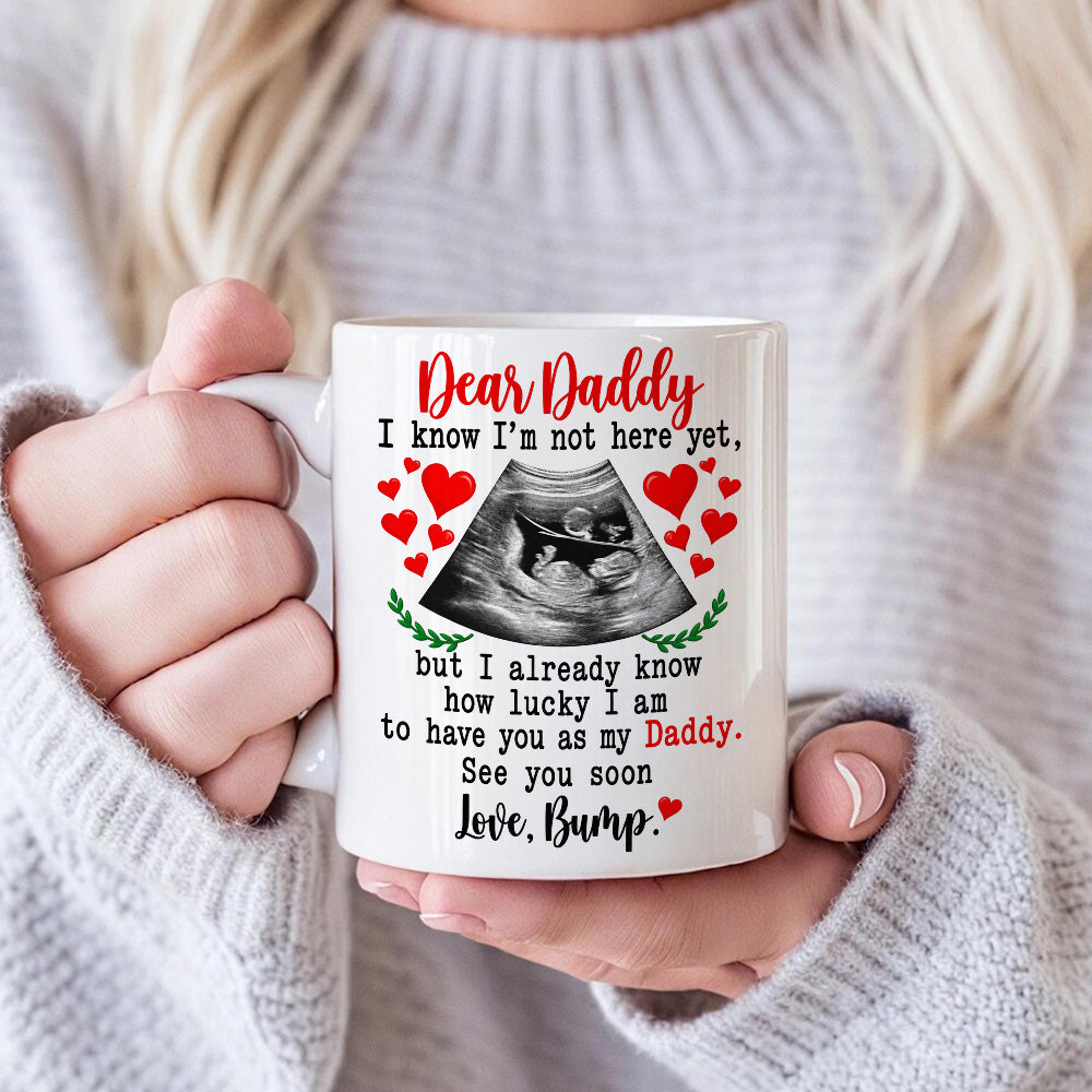 Dear Daddy I Know I am Lucky To Have You As My Dad Ultrasound Mug - Personalized Coffee Mug - Gift For Dad-Myprintsy
