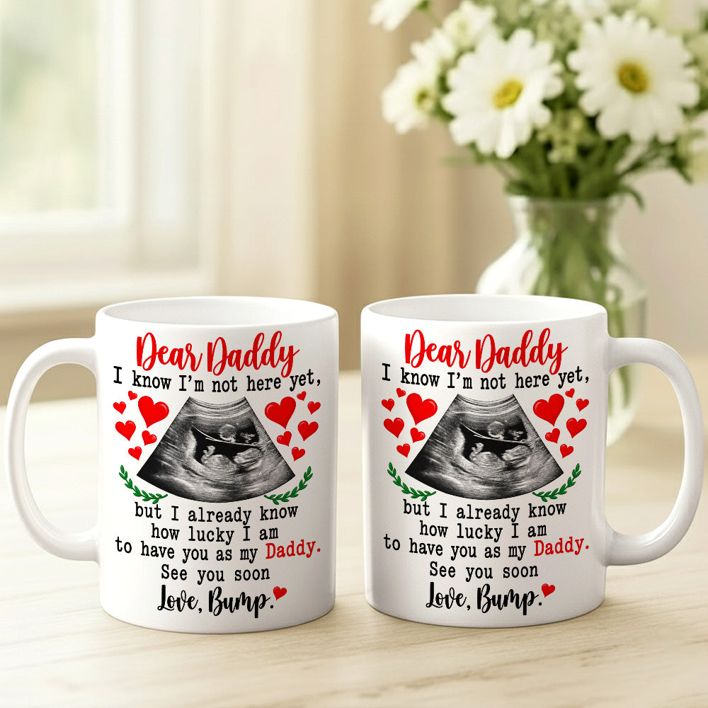 Dear Daddy I Know I am Lucky To Have You As My Dad Ultrasound Mug - Personalized Coffee Mug - Gift For Dad-Myprintsy