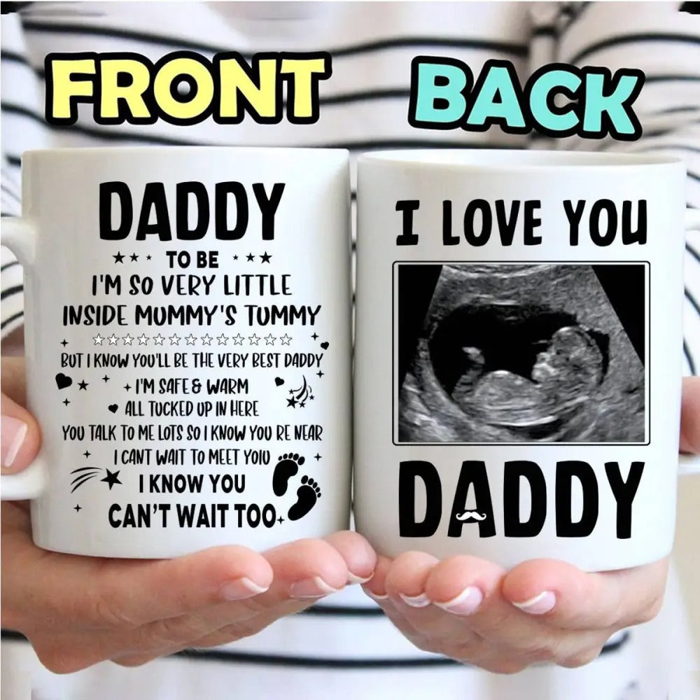 Personalized Ultrasound Sonogram Mug, Custom Baby Scan Photo Mug For New Daddy, First Father’s Day Gift From The Bump